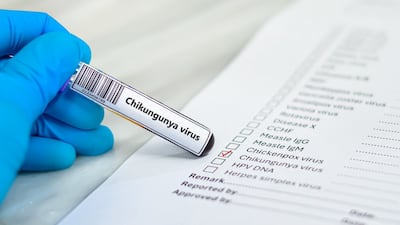 Valneva Asked To Strengthen Ixchiq Label After EMA’s Meningitis Signal Review 