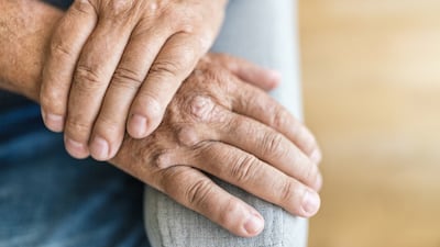 Zepbound And Taltz Combo Bolsters Lilly’s Co-Morbidity Plans