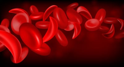 Hematologists Consider Where New Therapies Fit In Sickle Cell Treatment Paradigm