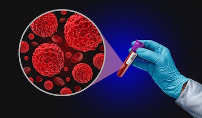 Guardant’s CMO On Future Of Liquid Biopsy, CDx, And Next Directions For Shield Test