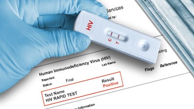 HIV Sample Collection Kit Vendors Face FDA Warnings
