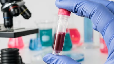 Companies Find Growth Opportunities In Maturing Colorectal Cancer Blood-Based Screening Market