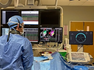 More Patients Free From Atrial Fibrillation With AI-Guided Pulmonary Vein Isolation Treatment