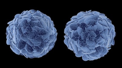 UK Biotech Quell Launches Trial To ‘Chill, Not Kill’ With Tregs