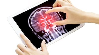 J&J Unit Cerenovus Recalls Aneurysm Treatment Systems Following Patient Death