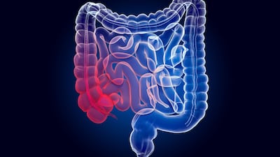 IBD Market Snapshot: Changes Ahead, But Current Biologics Are Formidable Competitors