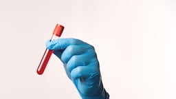 FDA Tissue Biopsy Draft Guidance Could Boost Liquid Biopsy Adoption In Clinical Trials 