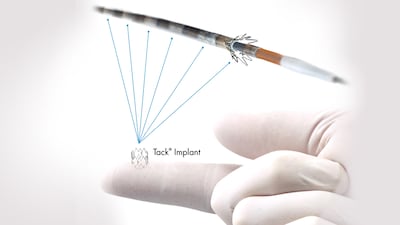 Intact Vascular’s Tack Peripheral Dissection Repair Device Earns PMA