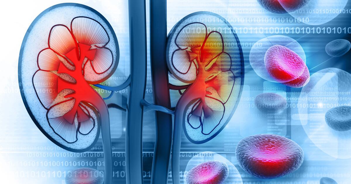 Soliris Imag Alexion’s Soliris Slips Up In Pivotal PROTECT Kidney Transplant Study