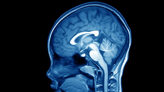 Linea Radiocava Mitsubishi’s Oral Radicava Provides Convenience Option For ALS