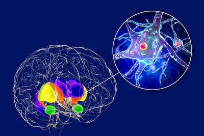 Is US FDA Following Correct Precedent With UniQure Gene Therapy Randomized Trial Demand? 