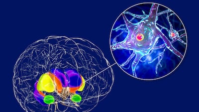 Is US FDA Following Correct Precedent With UniQure Gene Therapy Randomized Trial Demand?