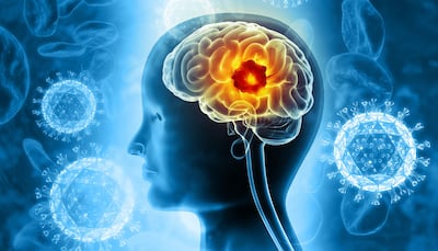 SEISMIC Potential: Minimally Invasive Brain Surgery Project Shows Scope Of EU IHI Funding 