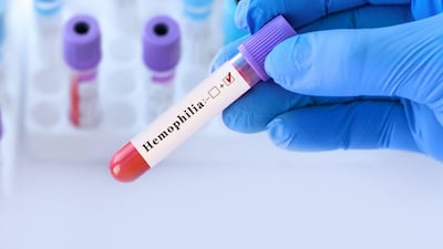 Pfizer’s Hemophilia A Gene Therapy Superior To Prophylaxis In Phase III