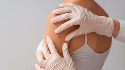 After CMS Coverage, Superficial Radiotherapy Firm Eyes Bigger Role In Skin Cancer Treatment