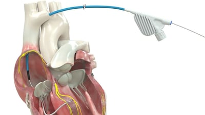 Medtronic Expands OmniaSecure Approval to Left Bundle Branch Pacing, Raising Competitive Stakes