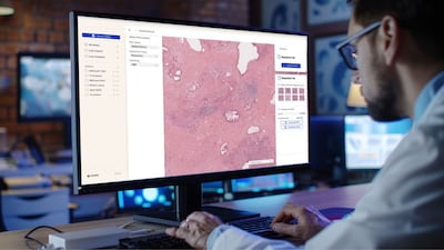 AI Precision Testing Will Be Standard Of Care Within 5 Years, Says Waiv CEO After $33M Raise