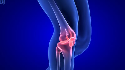 Sparta Breaks Through With Synthetic Cartilage To Address Osteoarthritis